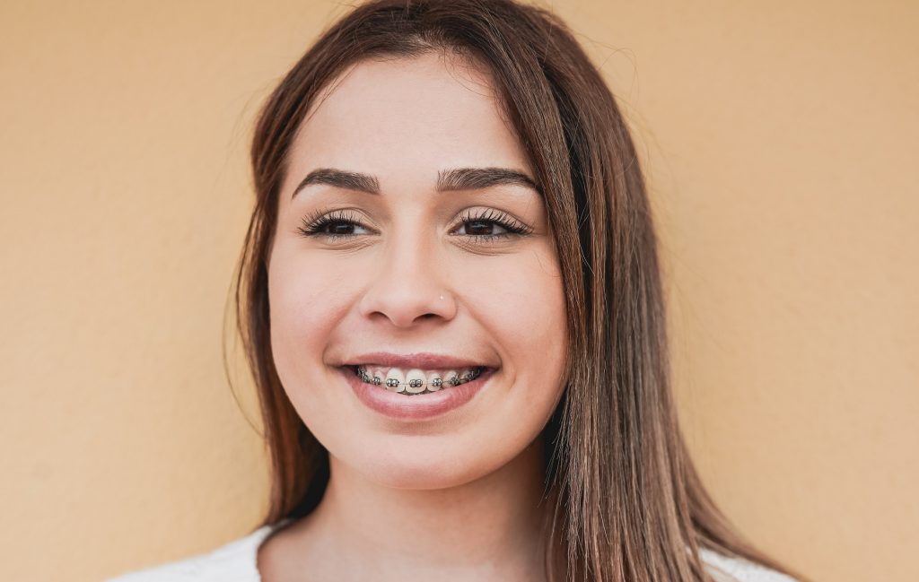 Invisalign Treatment