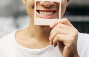 A Guide to Tooth Agenesis Treatment