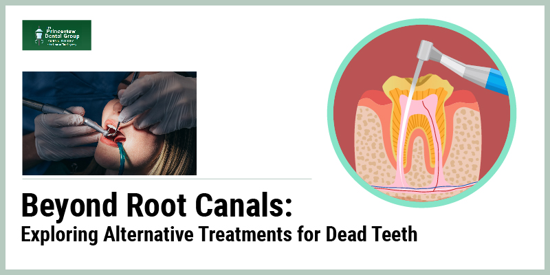 Alternative Treatments for Dead Teeth