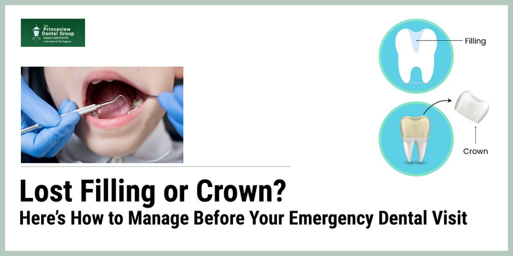 How to Manage Before Your Emergency Dental Visit