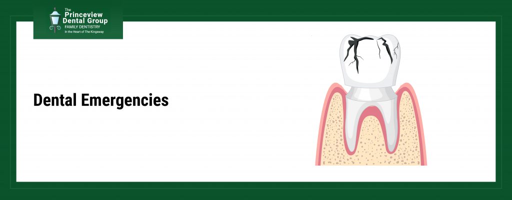 Dental Emergencies